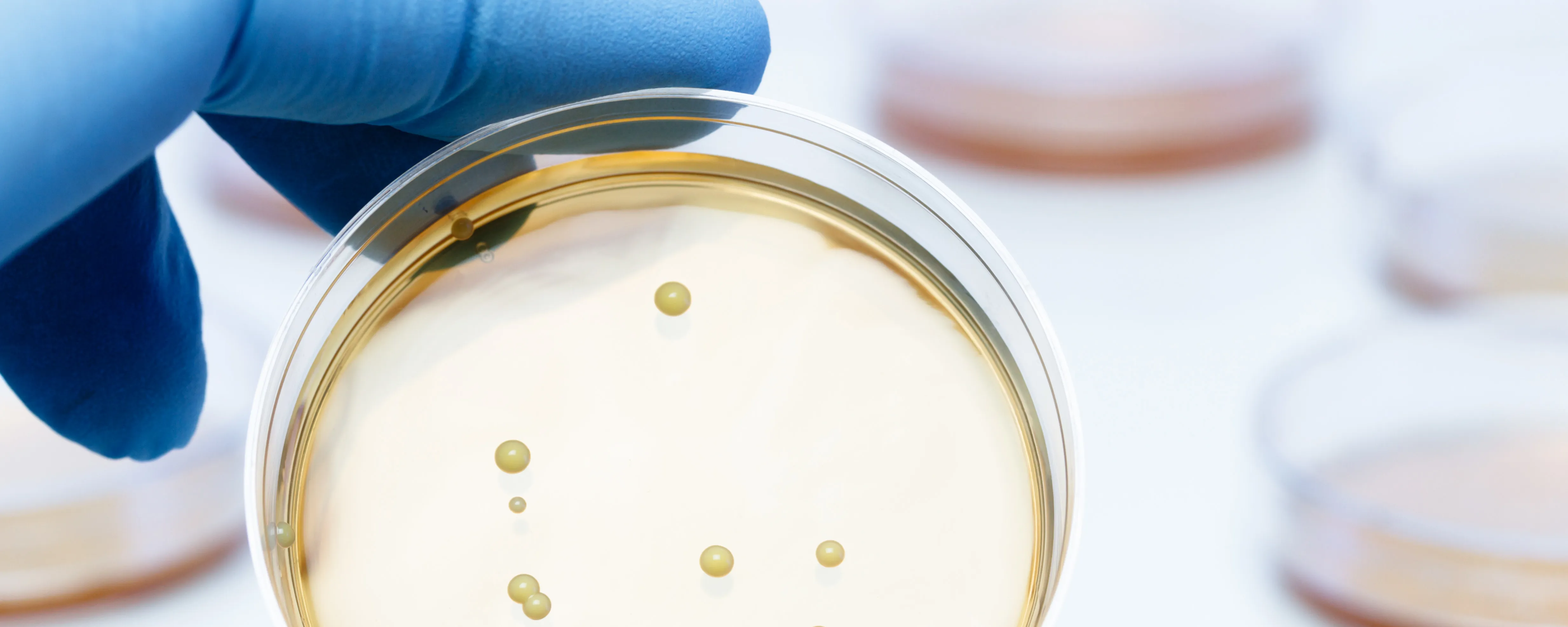 Effective Reliable Strain - Front Page Image 720X530